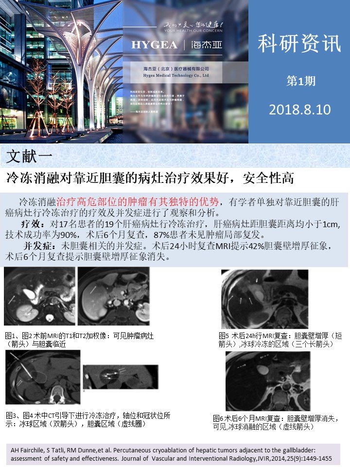 【JIUYOU.com科研资讯】第1期——肝、、、肺癌消融